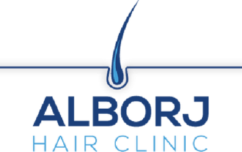 ALBORJ HAIR CLINIC – Hair Transplant