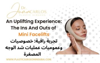 Mini face lift | Botched mini face lift